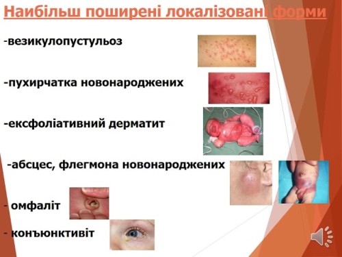 Відеотека